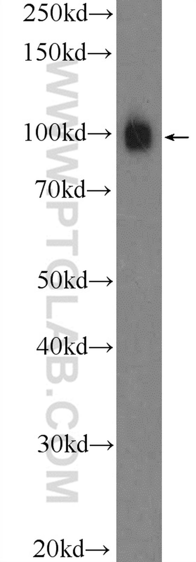 alpha Actinin Antibody in Western Blot (WB)