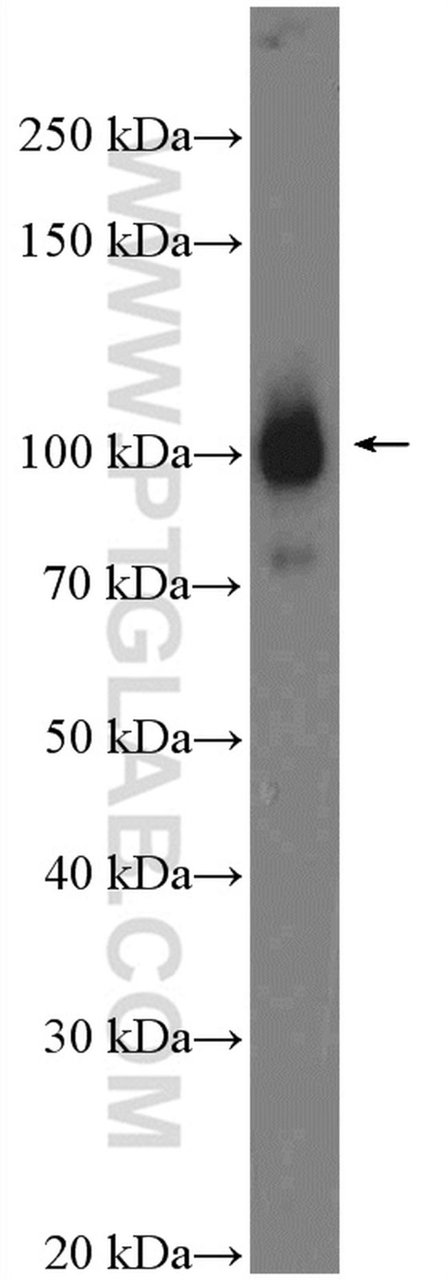 alpha Actinin Antibody in Western Blot (WB)