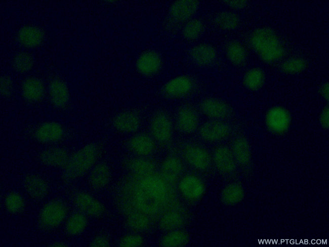 EYA2 Antibody in Immunocytochemistry (ICC/IF)