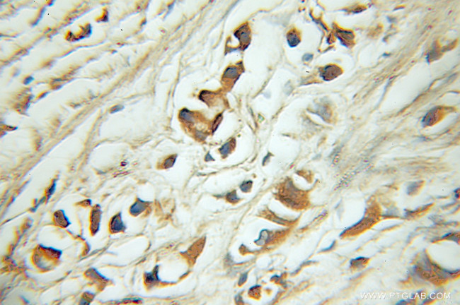 EYA2 Antibody in Immunohistochemistry (Paraffin) (IHC (P))