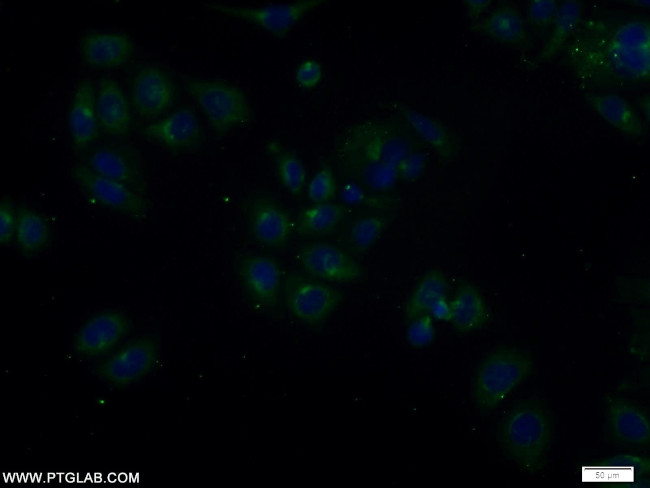 TOLLIP Antibody in Immunocytochemistry (ICC/IF)