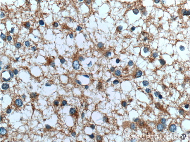 TOLLIP Antibody in Immunohistochemistry (Paraffin) (IHC (P))