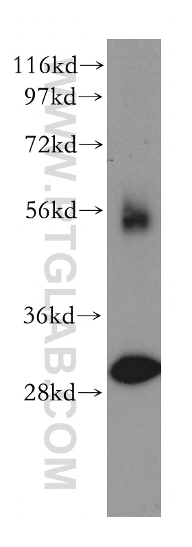 TOLLIP Antibody in Western Blot (WB)