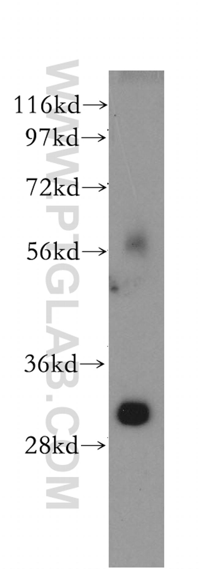 TOLLIP Antibody in Western Blot (WB)