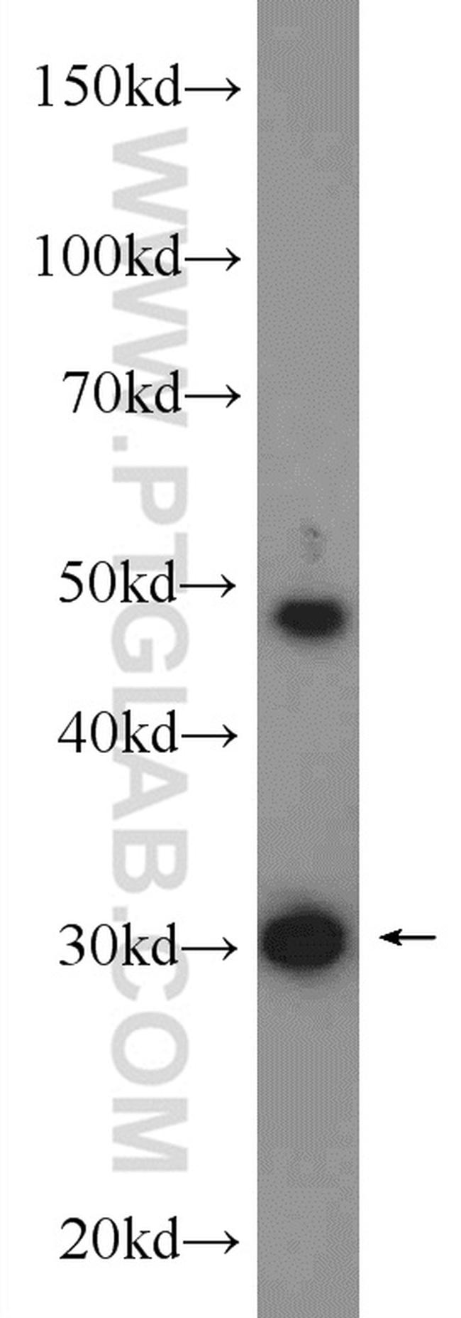 TOLLIP Antibody in Western Blot (WB)