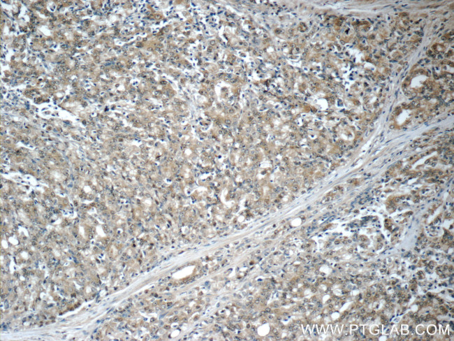 Aminoacylase 1 Antibody in Immunohistochemistry (Paraffin) (IHC (P))