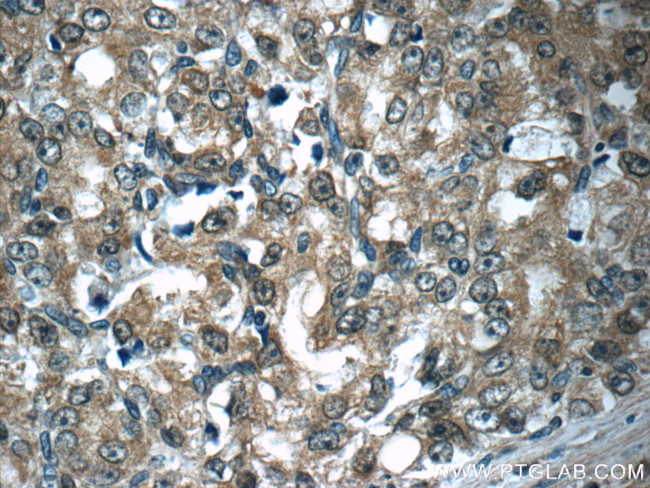 Aminoacylase 1 Antibody in Immunohistochemistry (Paraffin) (IHC (P))