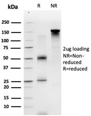 ECD/ SGT1 Antibody in SDS-PAGE (SDS-PAGE)