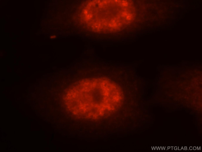 NASP Antibody in Immunocytochemistry (ICC/IF)