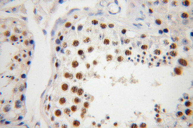 NASP Antibody in Immunohistochemistry (Paraffin) (IHC (P))