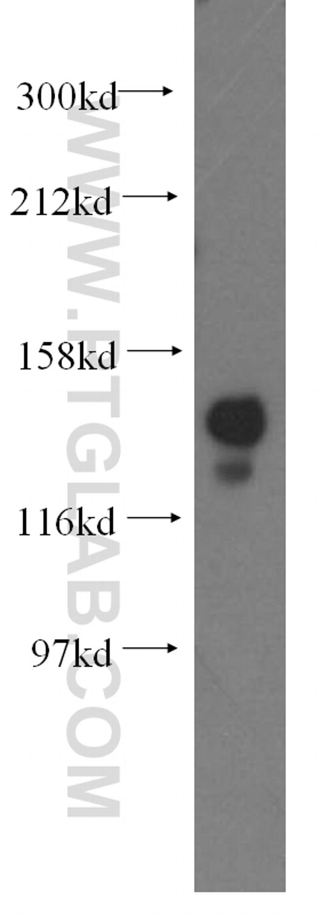 NASP Antibody in Western Blot (WB)