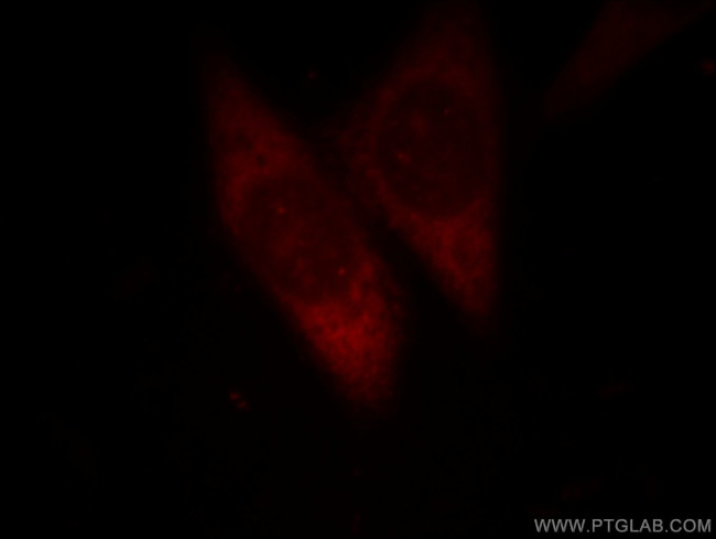 DDX20 Antibody in Immunocytochemistry (ICC/IF)