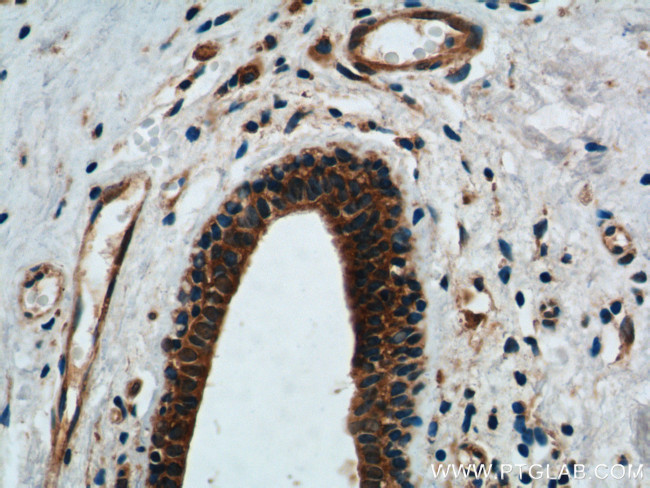 DDX20 Antibody in Immunohistochemistry (Paraffin) (IHC (P))