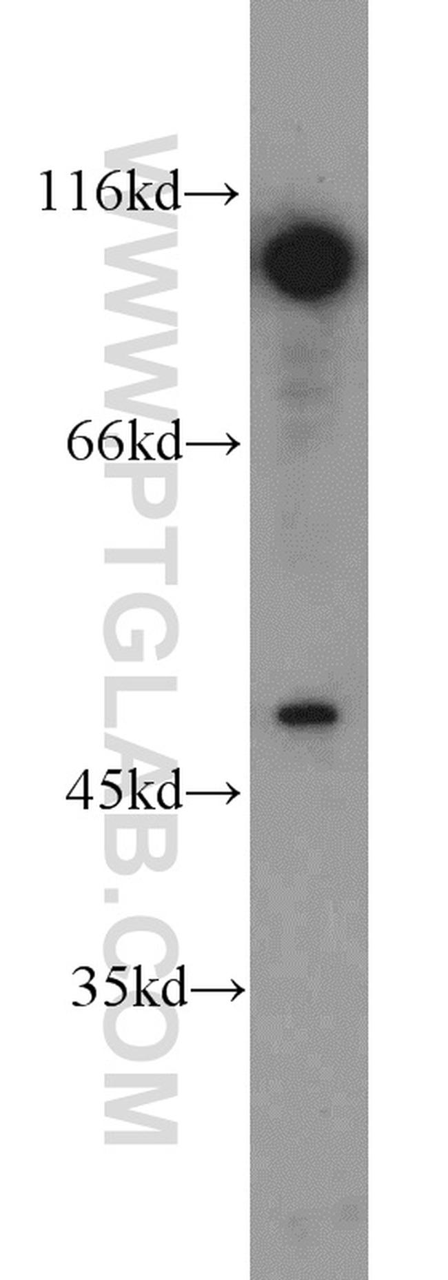 DDX20 Antibody in Western Blot (WB)