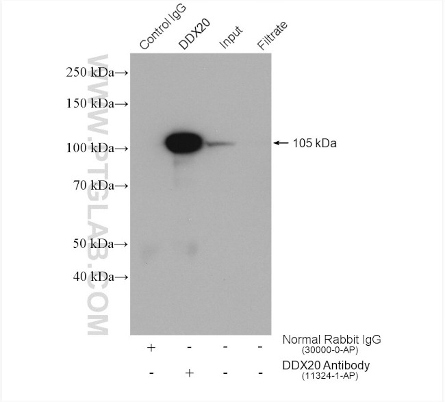 DDX20 Antibody in Immunoprecipitation (IP)