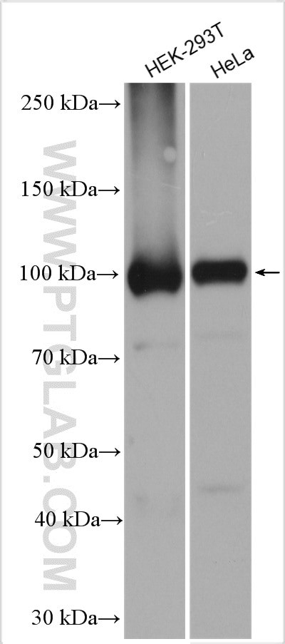 DDX20 Antibody in Western Blot (WB)