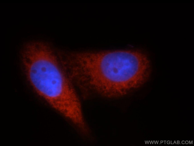 DDX20 Antibody in Immunocytochemistry (ICC/IF)