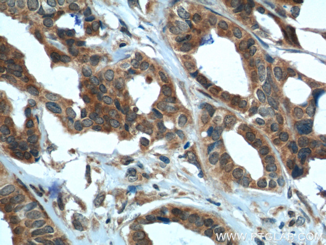 DDX20 Antibody in Immunohistochemistry (Paraffin) (IHC (P))