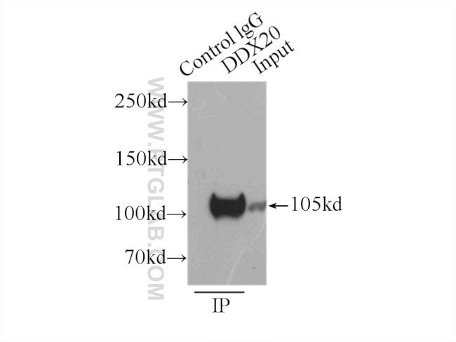 DDX20 Antibody in Immunoprecipitation (IP)