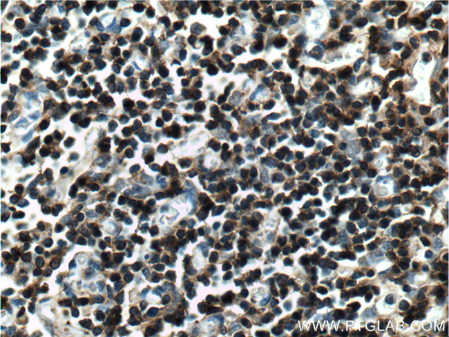 LAT Antibody in Immunohistochemistry (Paraffin) (IHC (P))