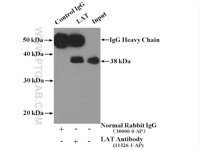 LAT Antibody in Immunoprecipitation (IP)