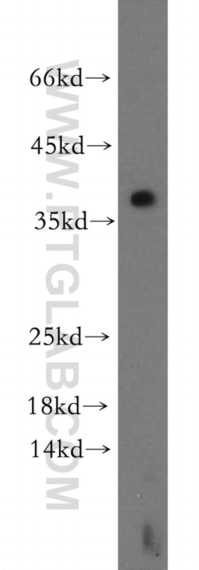 LAT Antibody in Western Blot (WB)