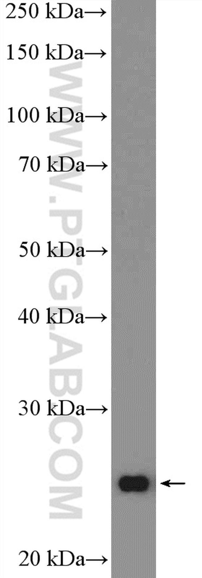 LAT Antibody in Western Blot (WB)