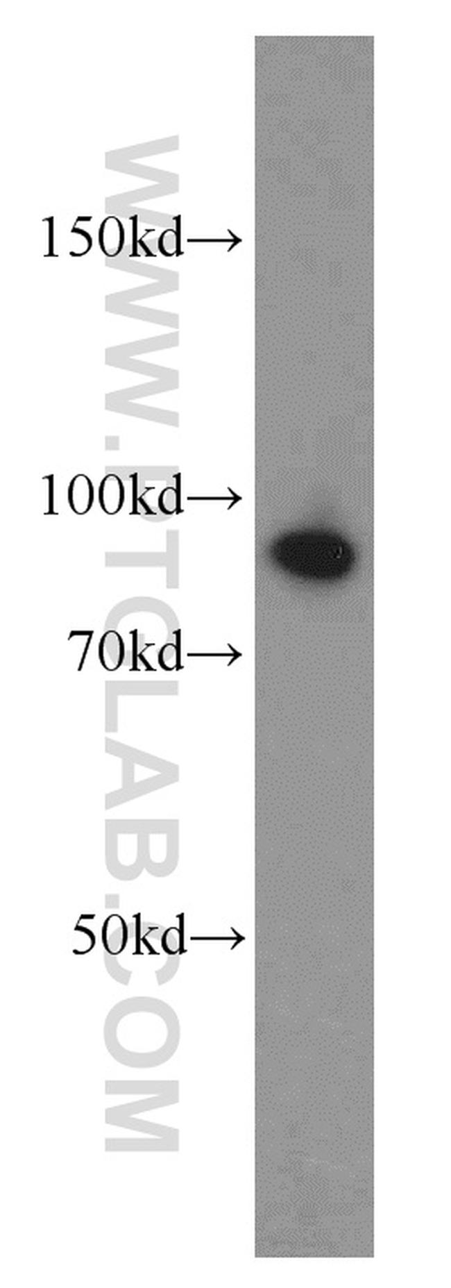 ATRIP Antibody in Western Blot (WB)