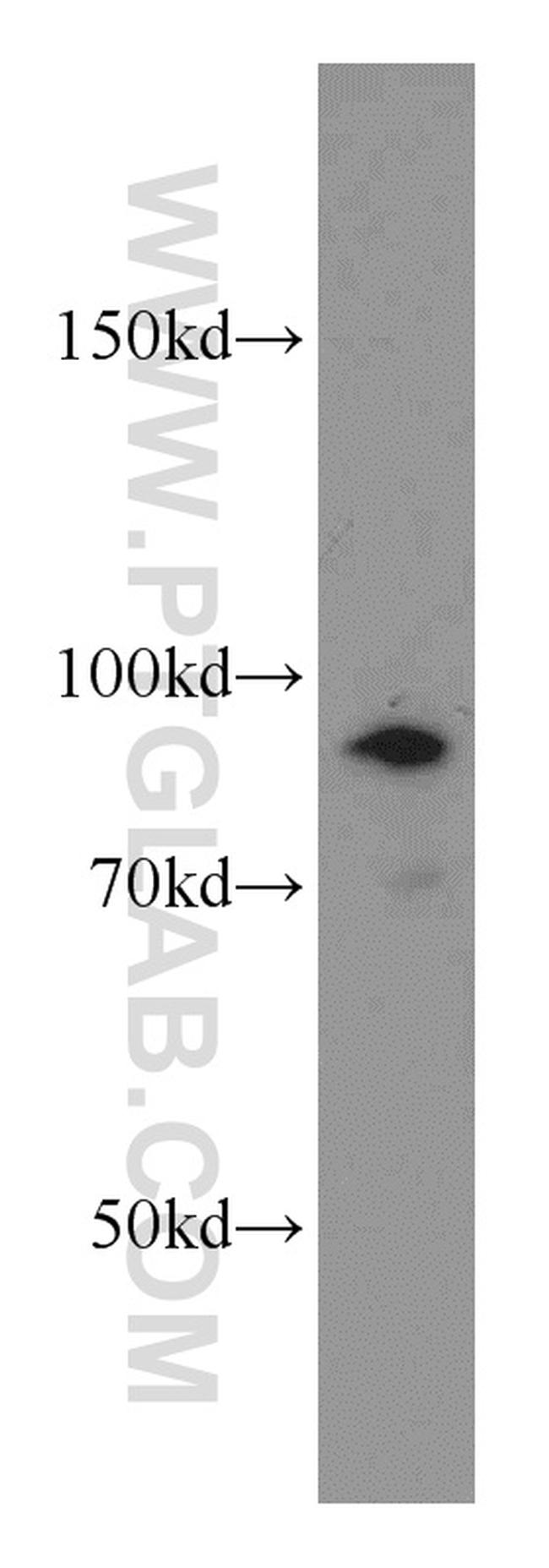 ATRIP Antibody in Western Blot (WB)