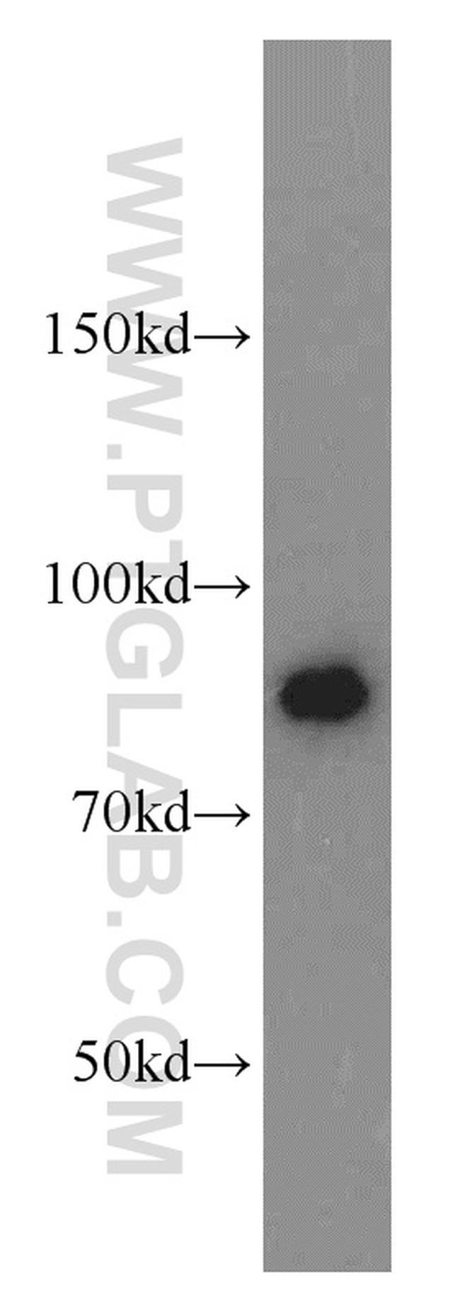 ATRIP Antibody in Western Blot (WB)