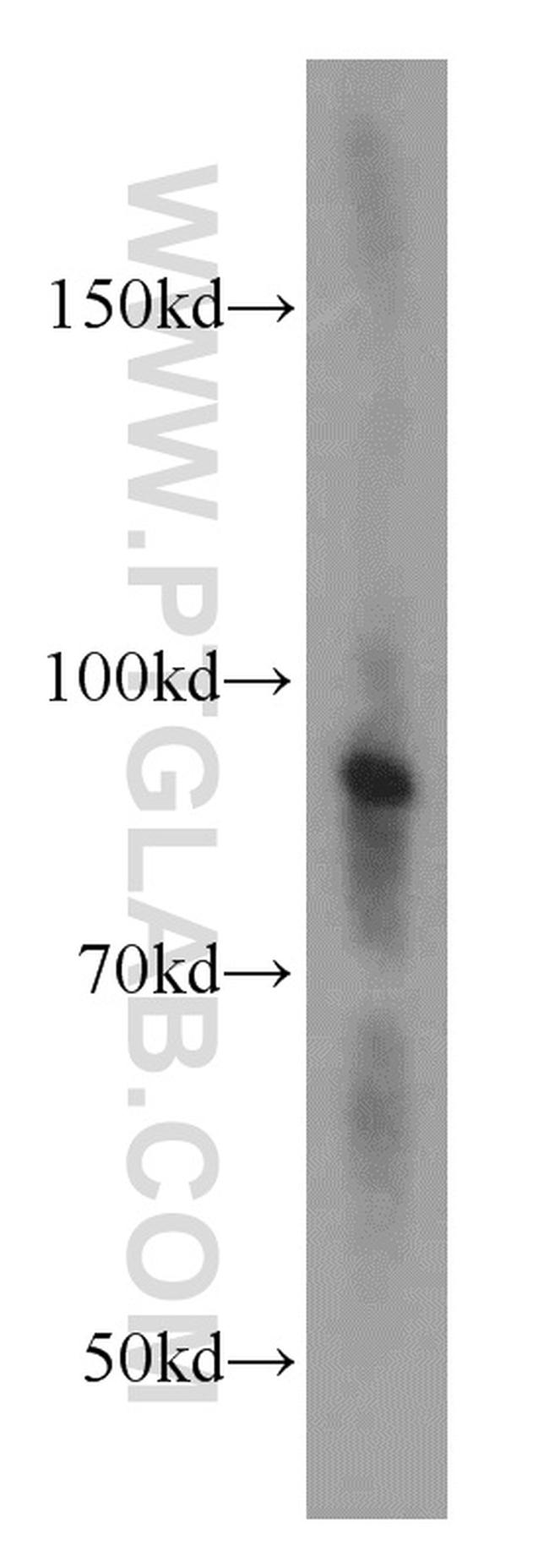 ATRIP Antibody in Western Blot (WB)