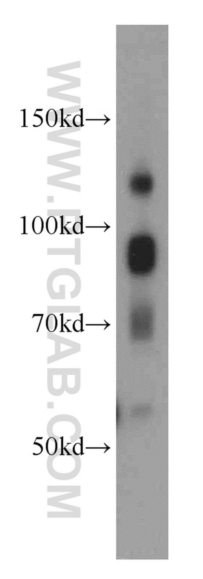 ATRIP Antibody in Western Blot (WB)