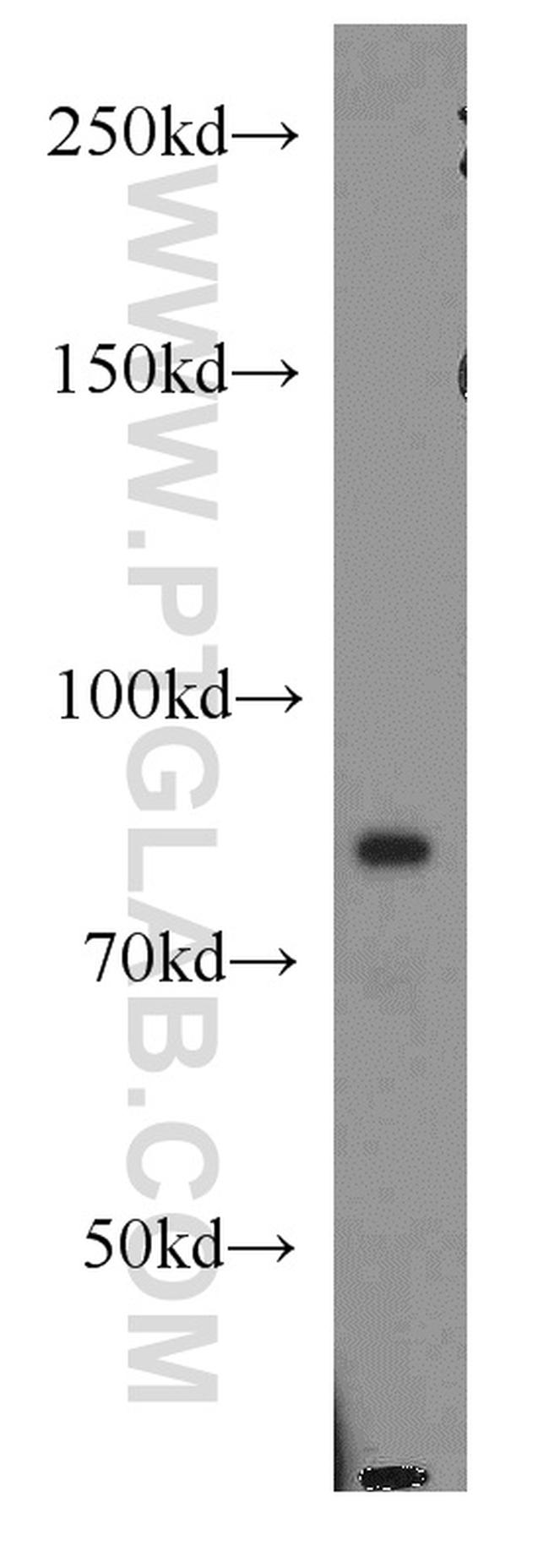 ATRIP Antibody in Western Blot (WB)