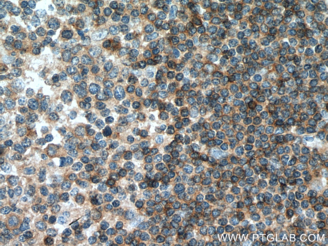 Integrin beta-7 Antibody in Immunohistochemistry (Paraffin) (IHC (P))