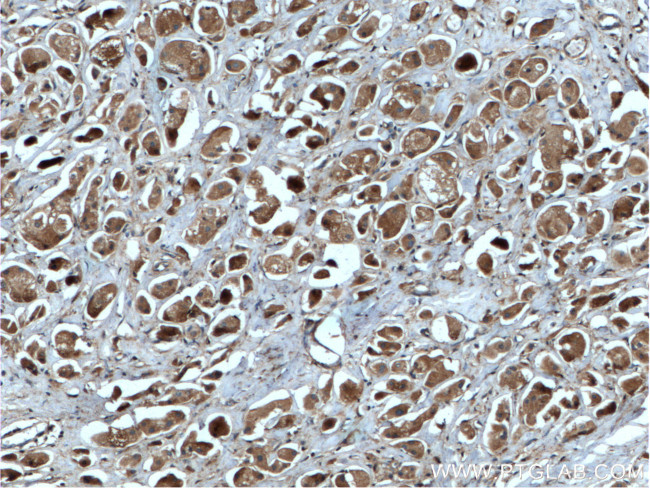 RAB35 Antibody in Immunohistochemistry (Paraffin) (IHC (P))