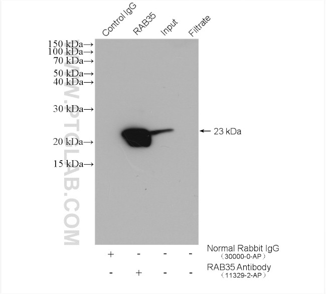 RAB35 Antibody in Immunoprecipitation (IP)