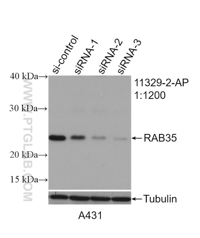 RAB35 Antibody in Western Blot (WB)