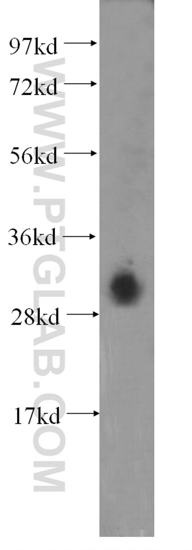 DNASE1L3 Antibody in Western Blot (WB)