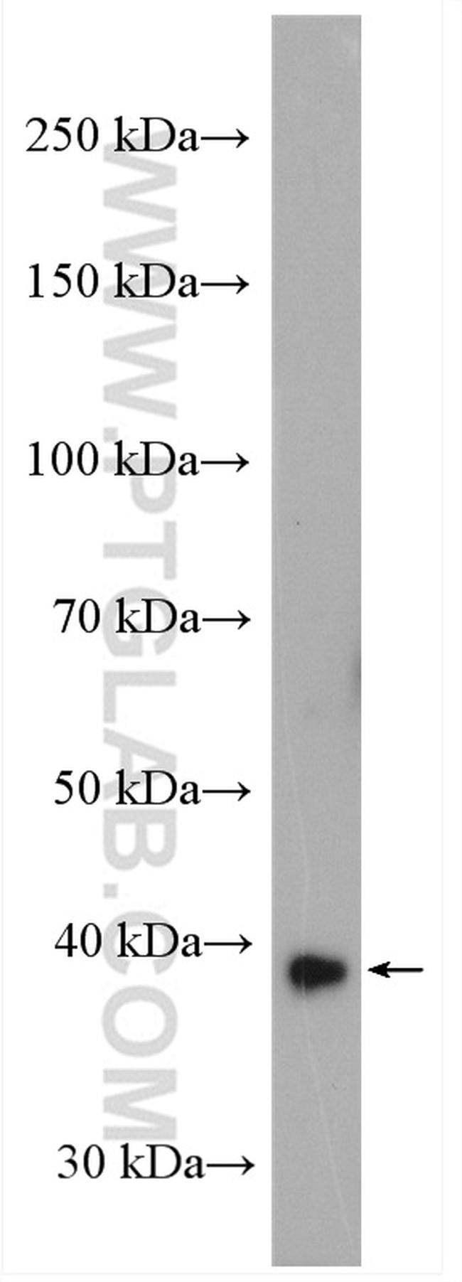 DNASE1L3 Antibody in Western Blot (WB)