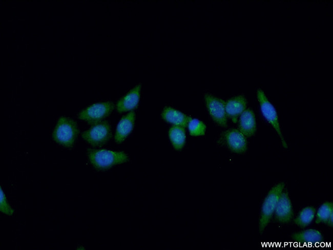 XPG Antibody in Immunocytochemistry (ICC/IF)