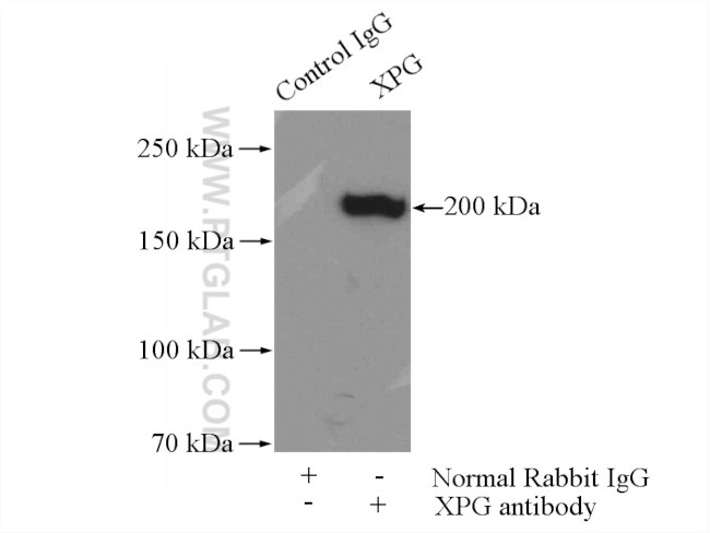 XPG Antibody in Immunoprecipitation (IP)