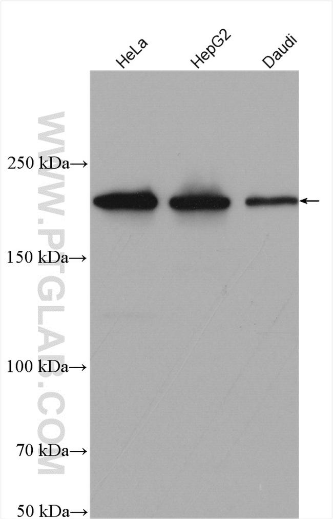 XPG Antibody in Western Blot (WB)