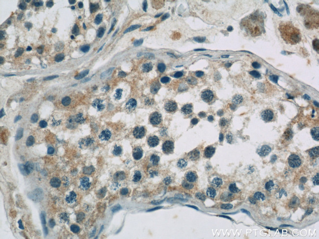 EIF2B4 Antibody in Immunohistochemistry (Paraffin) (IHC (P))