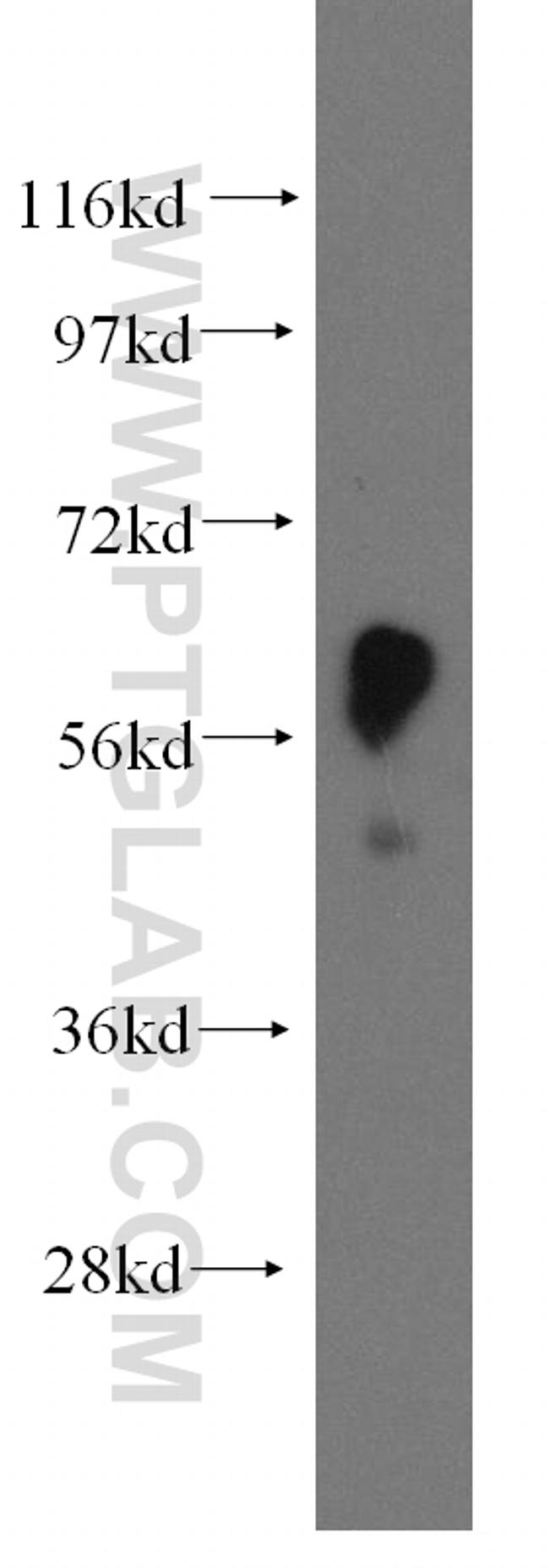 EIF2B4 Antibody in Western Blot (WB)