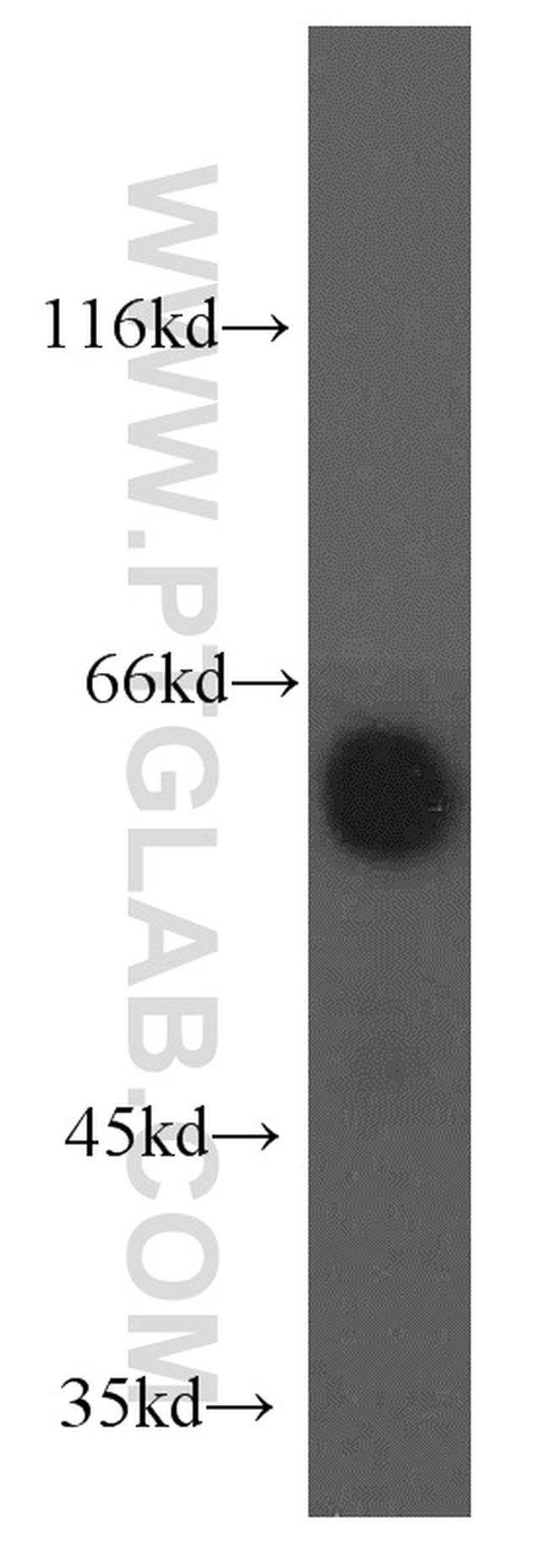 EIF2B4 Antibody in Western Blot (WB)