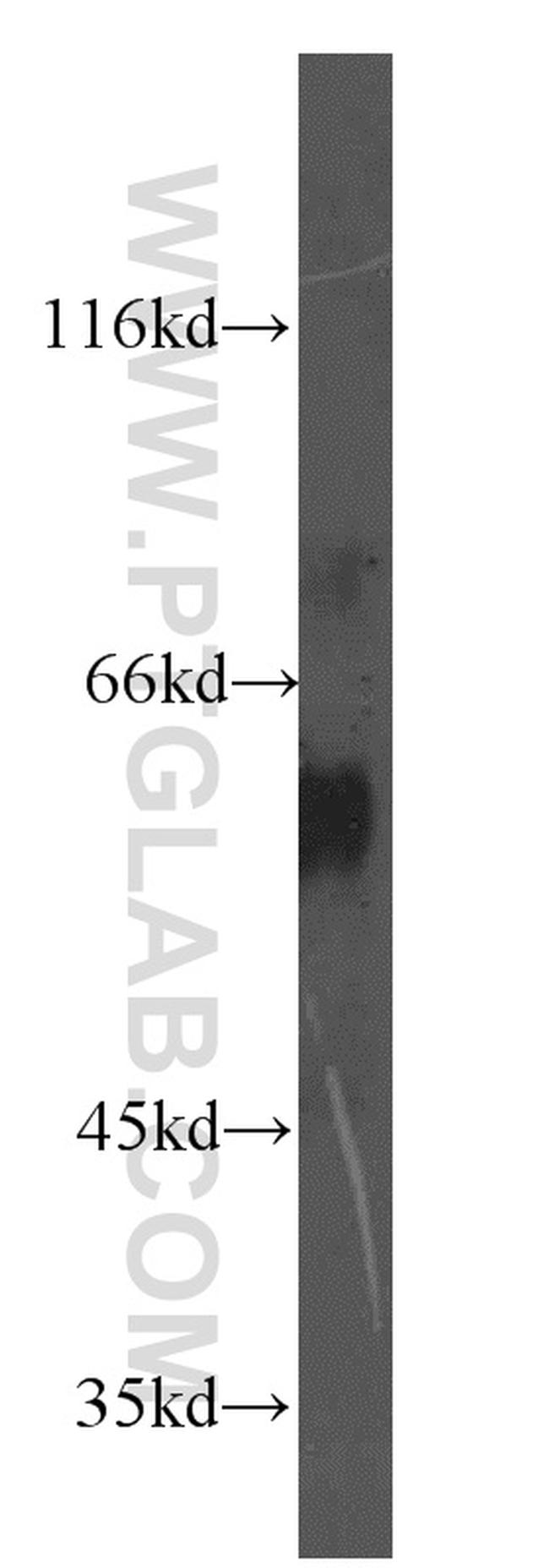 EIF2B4 Antibody in Western Blot (WB)