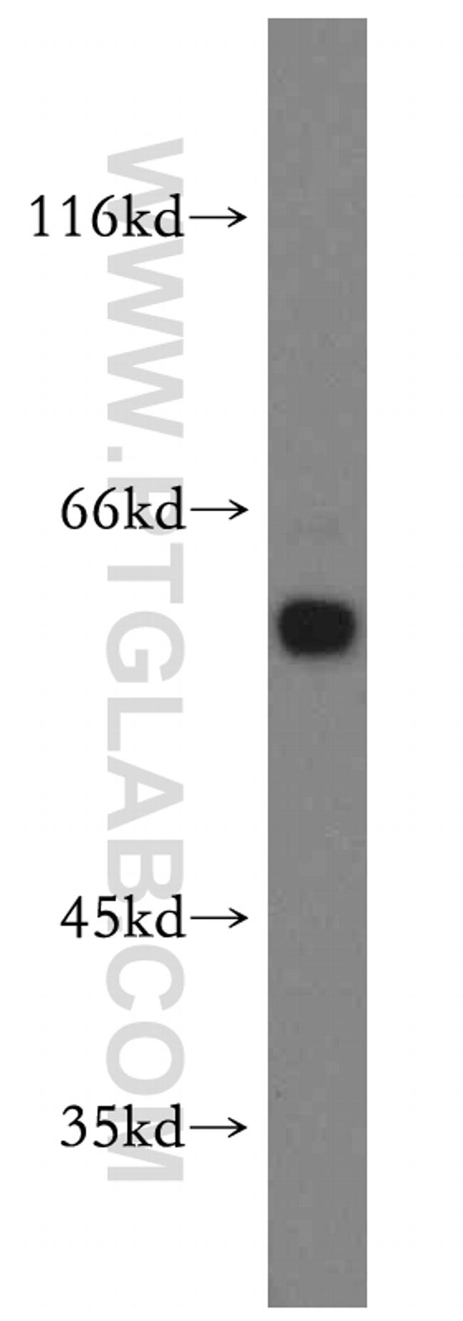 EIF2B4 Antibody in Western Blot (WB)