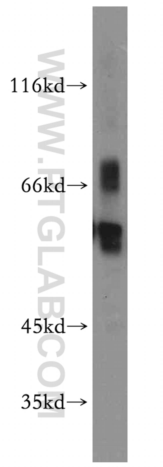 EIF2B4 Antibody in Western Blot (WB)