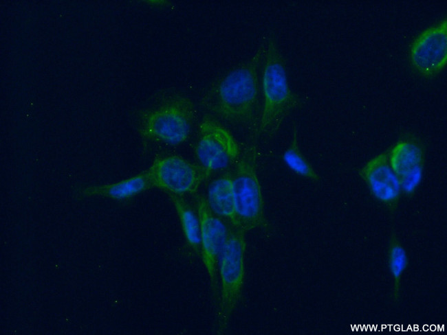 EIF2B4 Antibody in Immunocytochemistry (ICC/IF)