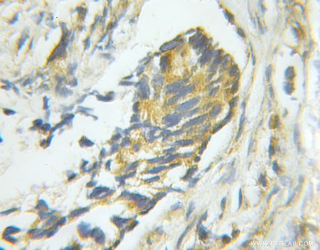 PTP1B Antibody in Immunohistochemistry (Paraffin) (IHC (P))